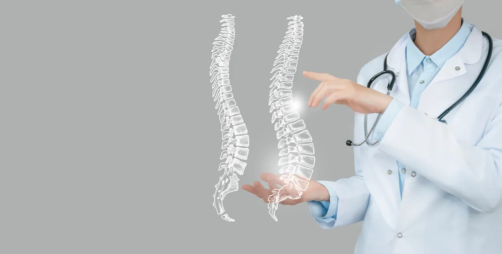 Spine -structure